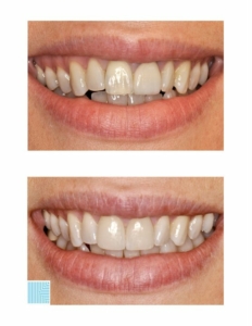 Melissa Leone, DDS
