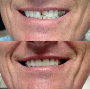 White Center Smiles