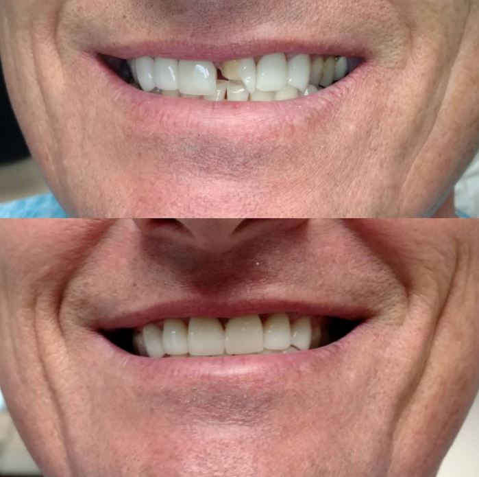 White Center Smiles
