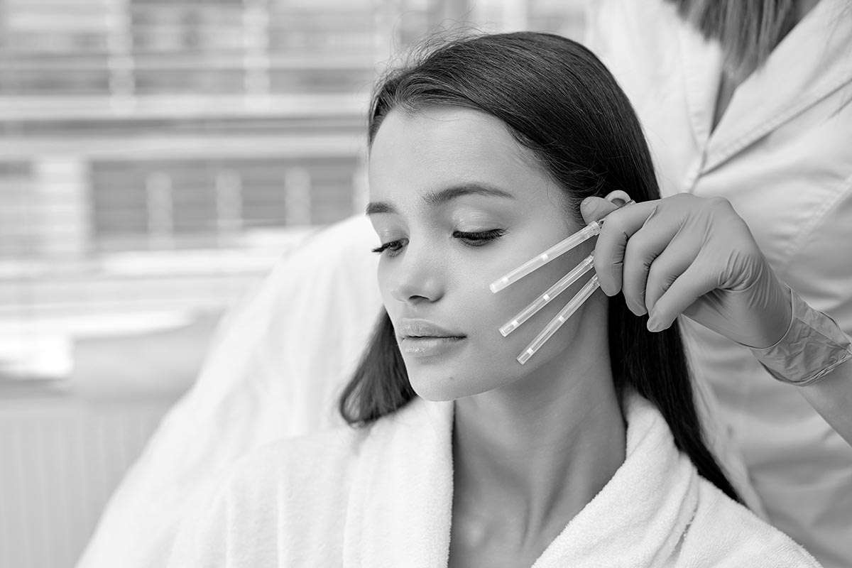 Side view close-up photo of young brunette female came to cosmetologist to get PDO thread, Thread Lifting procedure. Aesthetic beauty anti aging, face lifting surgery. Choosing the best thread